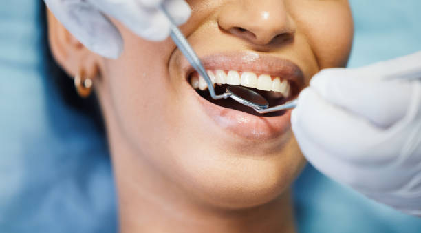 Best Emergency Dental Surgery in Beale Af, CA